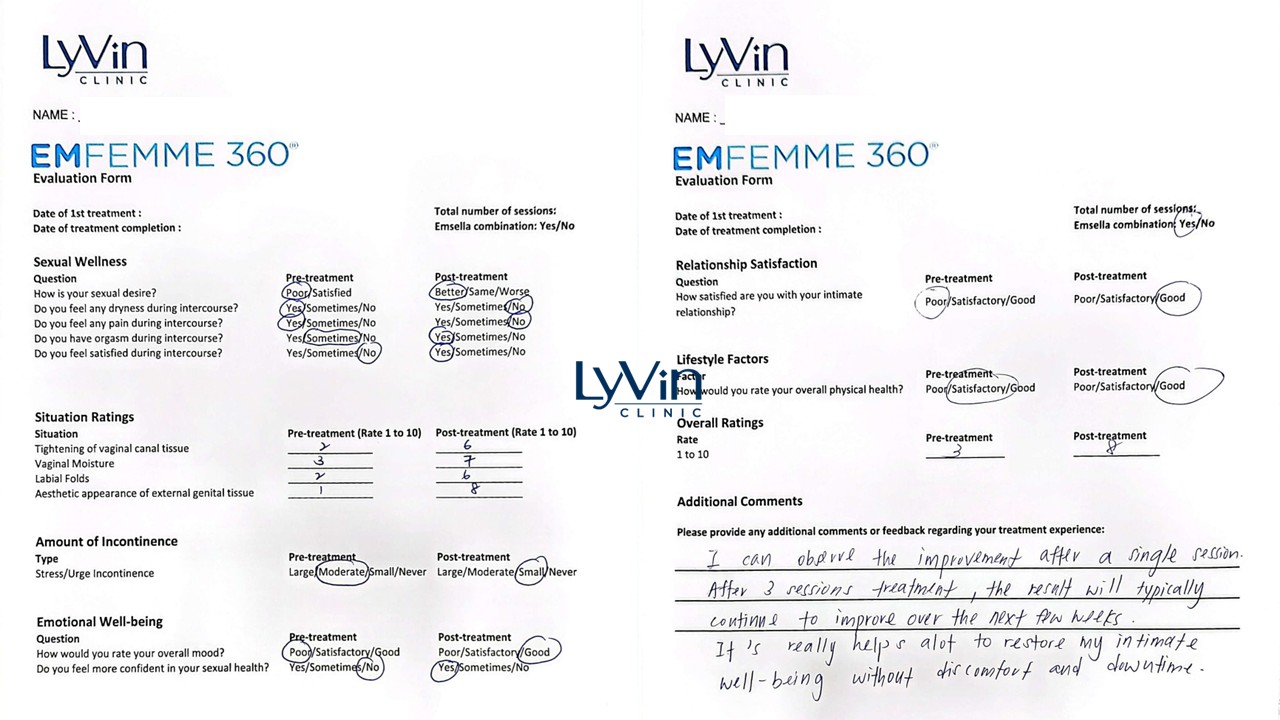 Non-surgical vaginal rejuvenation results with Emfemme 360 Non-surgical vaginal rejuvenation results with Emfemme 360